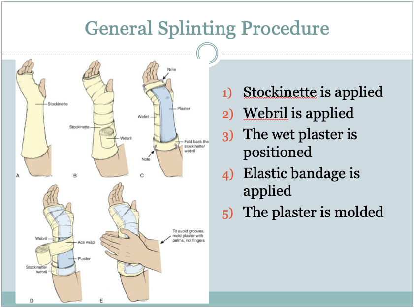 Orthopedic Teaching: Orthopedic Teaching: Feinberg School Of Medicine ...